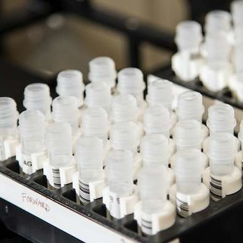 Mobile Drug Testing | US Drug Test Centers