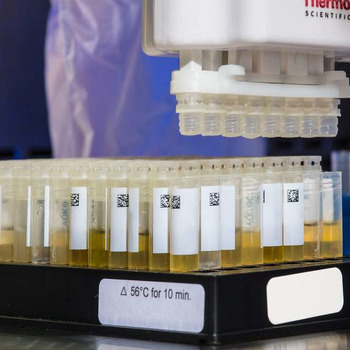 How Long Does Fentanyl Stay In Your System? | US Drug Test Centers