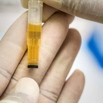 The Difference Between a DOT and Non-DOT Drug Test