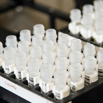 How Long Does it Take to Get Drug Test Results? | US Drug Test Centers