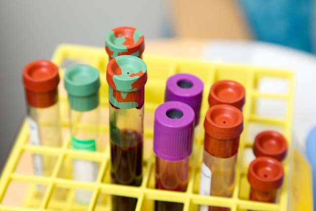 A set of clear glass test tubes with blood samples