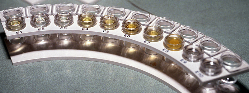 Urine Drug Testing