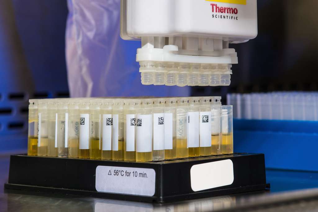 Urine samples in test tubes being examined