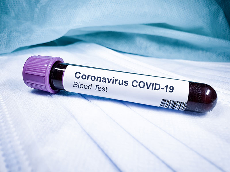 Covid-19 Blood Test
