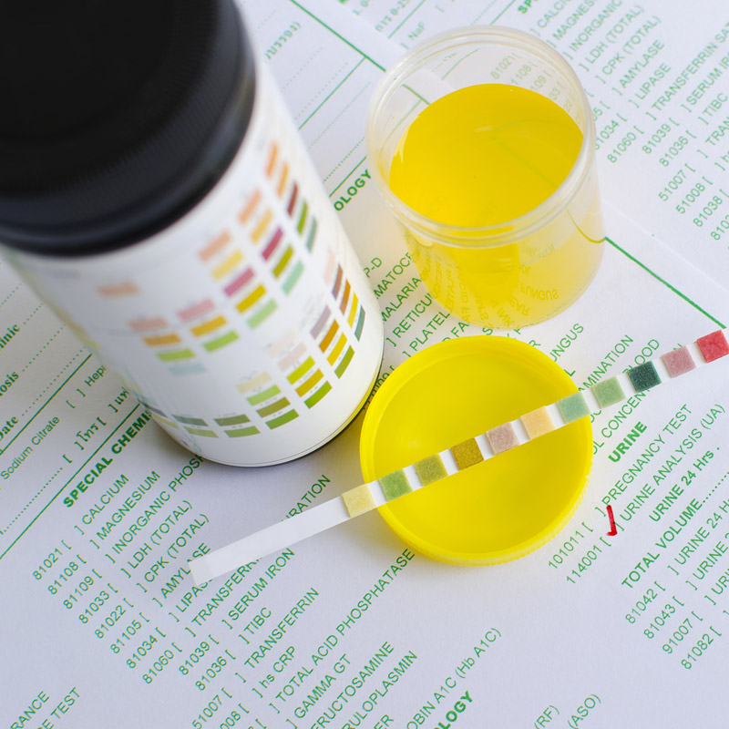 Urine Testing